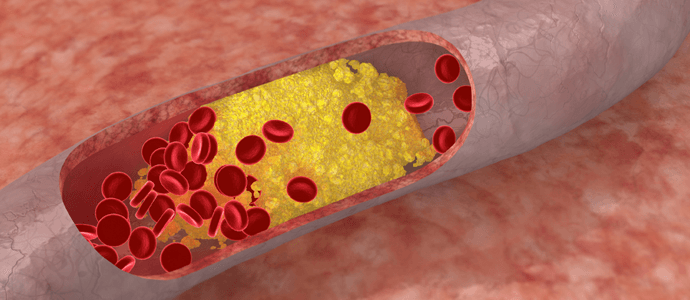 Cholesterolis