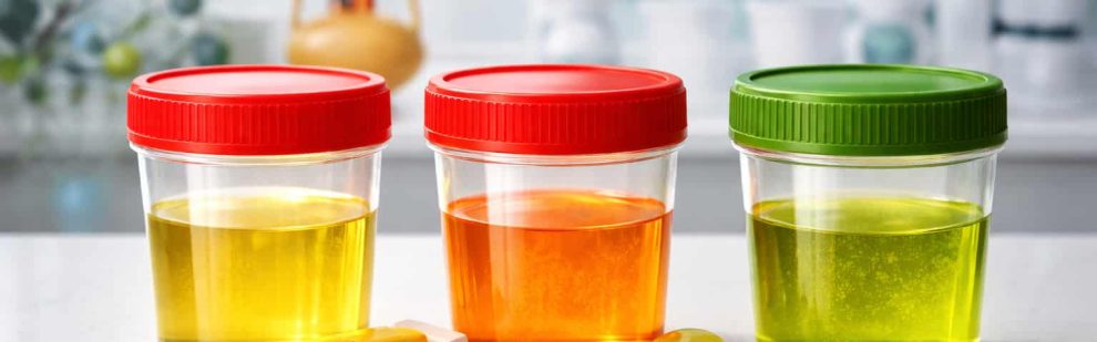 Šlapimo spalva ir vitaminų poveikis